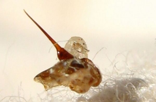  Picadura de abeja con veneno