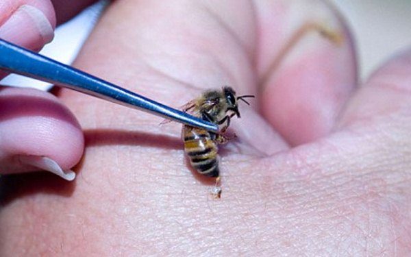  Apiterapia
