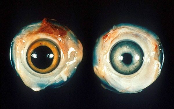  Eyes hurt the birds
