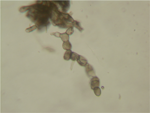  Spore fungus spores under the microscope