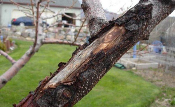  Sunburn of the trunk