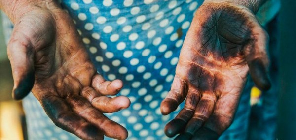  Dirty hands after nuts