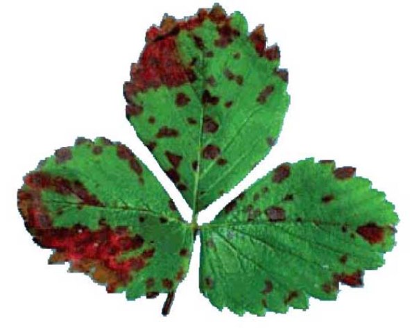 Bacterial burn