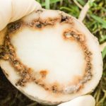 Tumba tuberculoasă